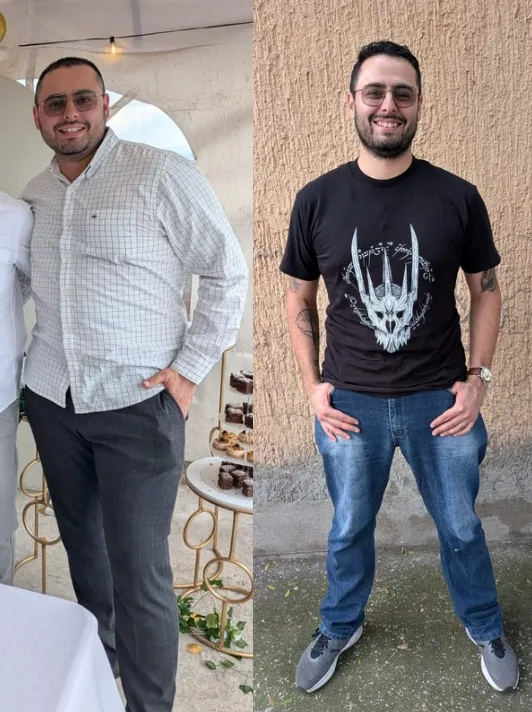 Jesús G. antes y después del tratamiento en Clínica CAMBIO