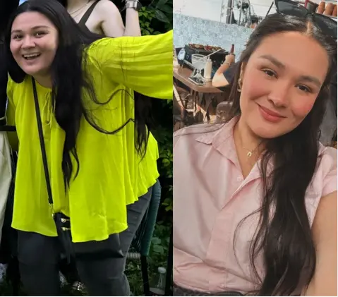 María José antes y después del tratamiento en Clínica CAMBIO